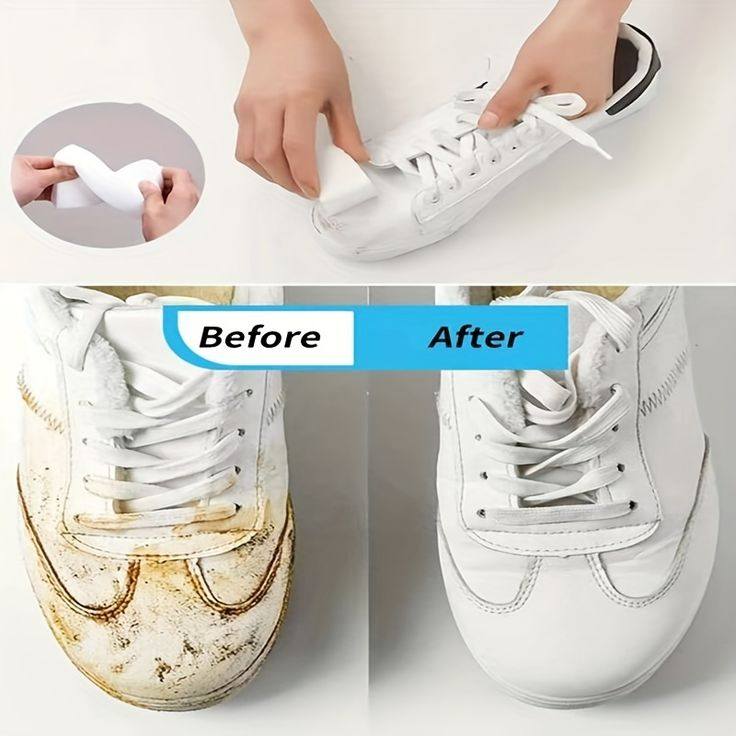 Very white shoes, nothing but bleach: this is how all the stains are removed | Now everyone does it!